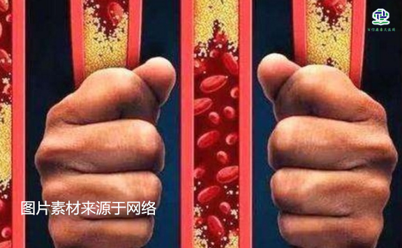不想給血管&ldquo;添堵&rdquo;，盡量少吃以下這些東西，或許能讓腦梗離遠些  